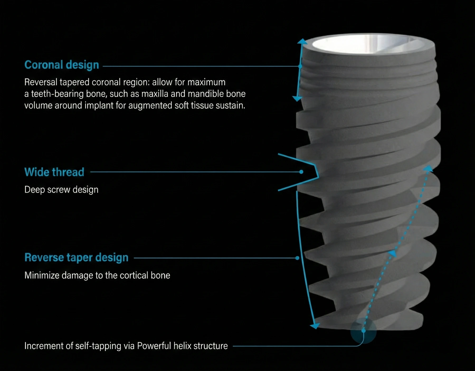 Имплант серии Nx